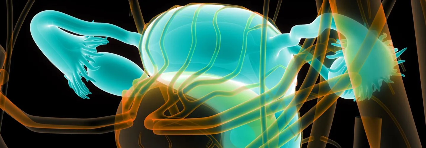 asherman sendromu rahim içi yapışıklık illüstrasyonu