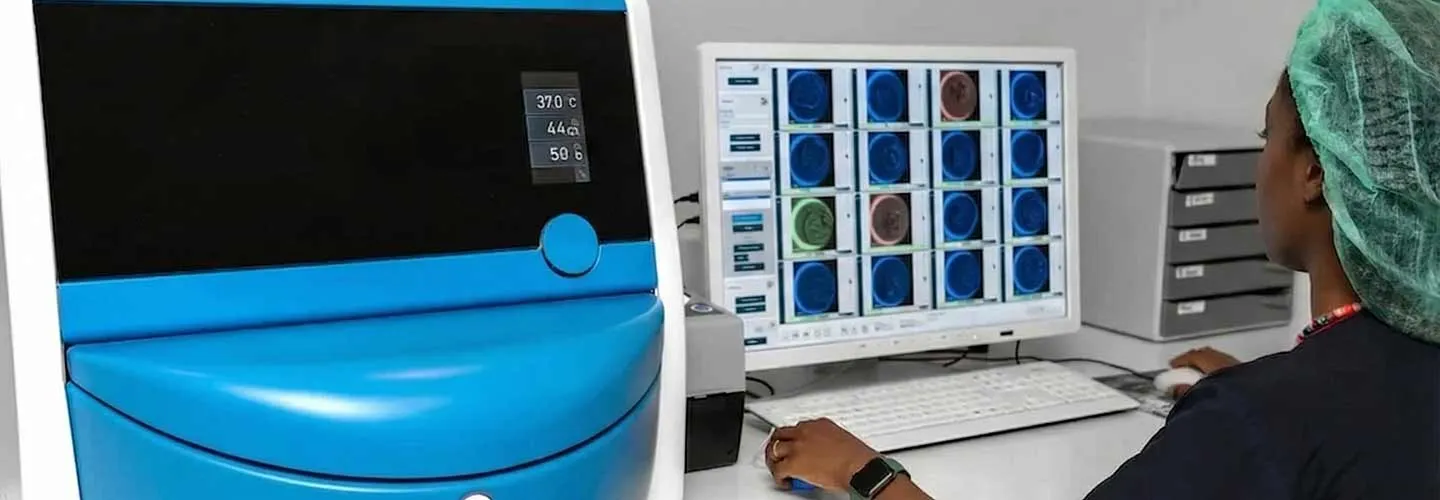 Uluslararası karşılaştırma